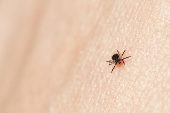 Lyme : les généralistes et les infectiologues refusent de signer les recommandations officielles en l'état