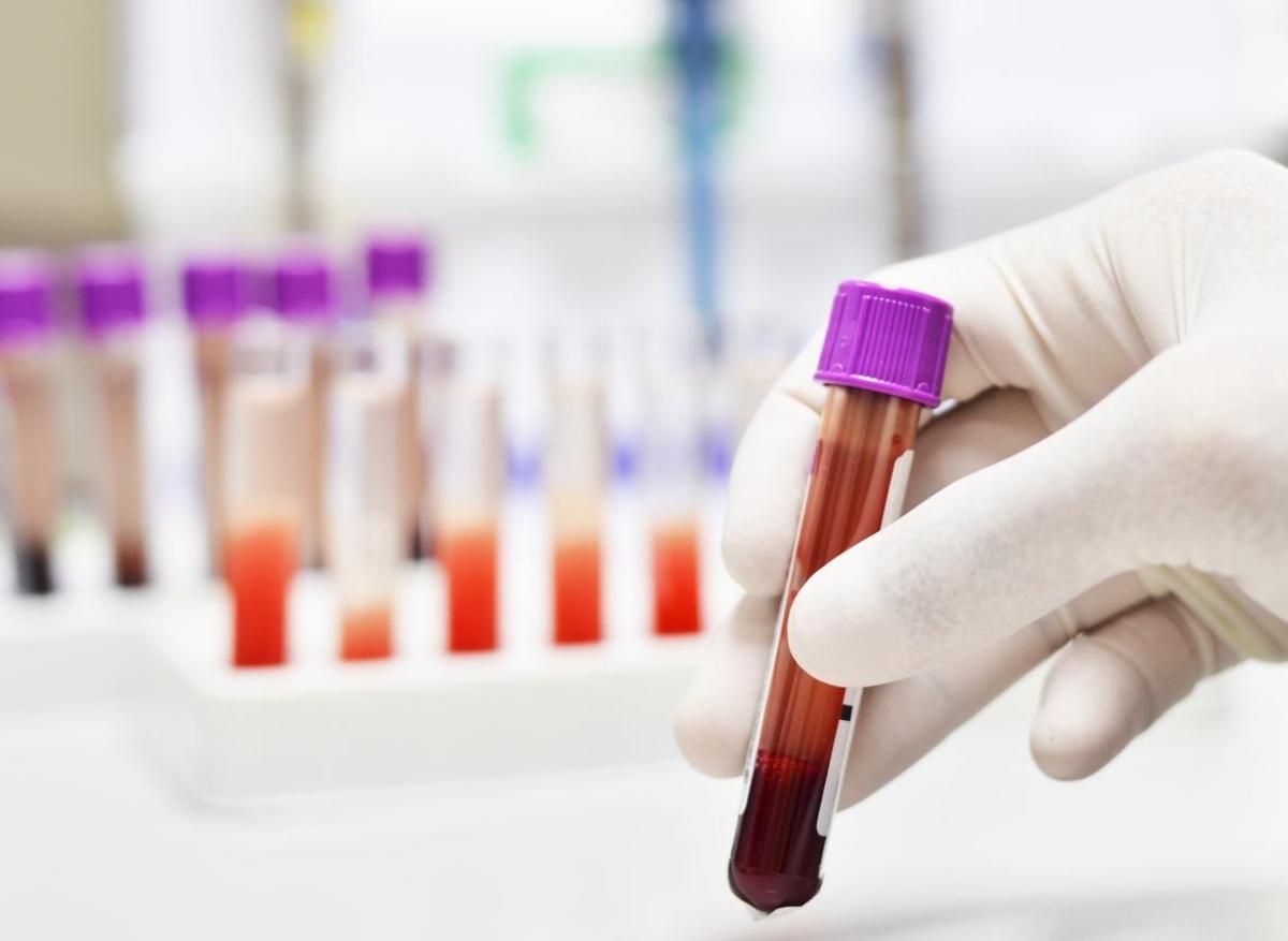 Cancers : un test sanguin pour en détecter plus de 50 précocément