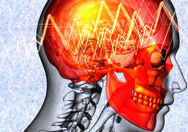 Lombalgie chronique: la stimulation électrique d’une région du cerveau soulage les douleurs