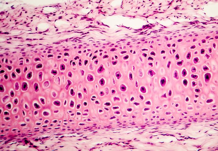 Ostéoporose : une nouvelle cible pour le maintien de l’action des ostéoblastes après la ménopause