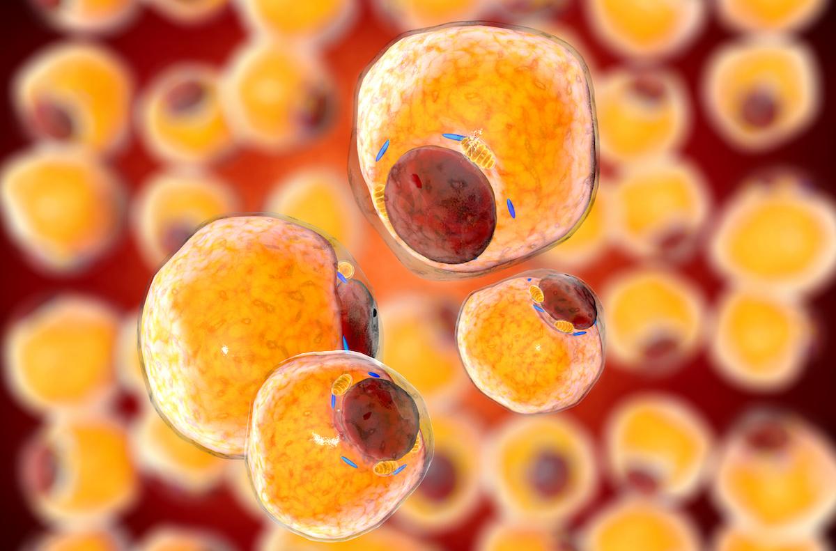 Covid-19 : la graisse est à risque pour le pronostic de l’infection à SARS-CoV-2