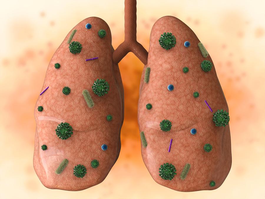 BPCO : des stratégies spécifiques contre les Haemophilus influenzae pathogènes