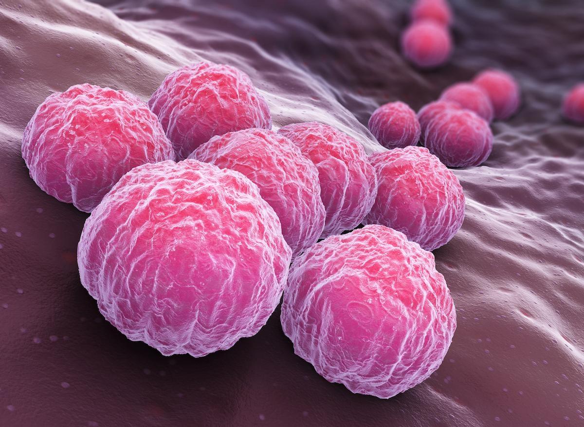 Chlamydia : risque accru de cancer et de grossesse extra-utérine