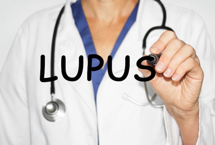 Lupus : des anomalies précoces sur la lignée lymphocytaire B 