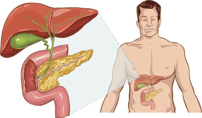  Cancer du pancréas : un nouveau test diagnostique sanguin