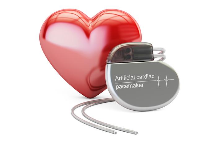 Insuffisance cardiaque: des microstimulateurs implantables sans fil pour sauver le coeur d’un octogénaire. VIDEO 