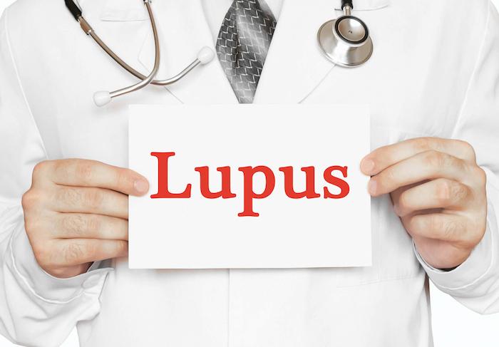 Lupus érythémateux disséminé : le sirolimus diminue l'activité de la maladie