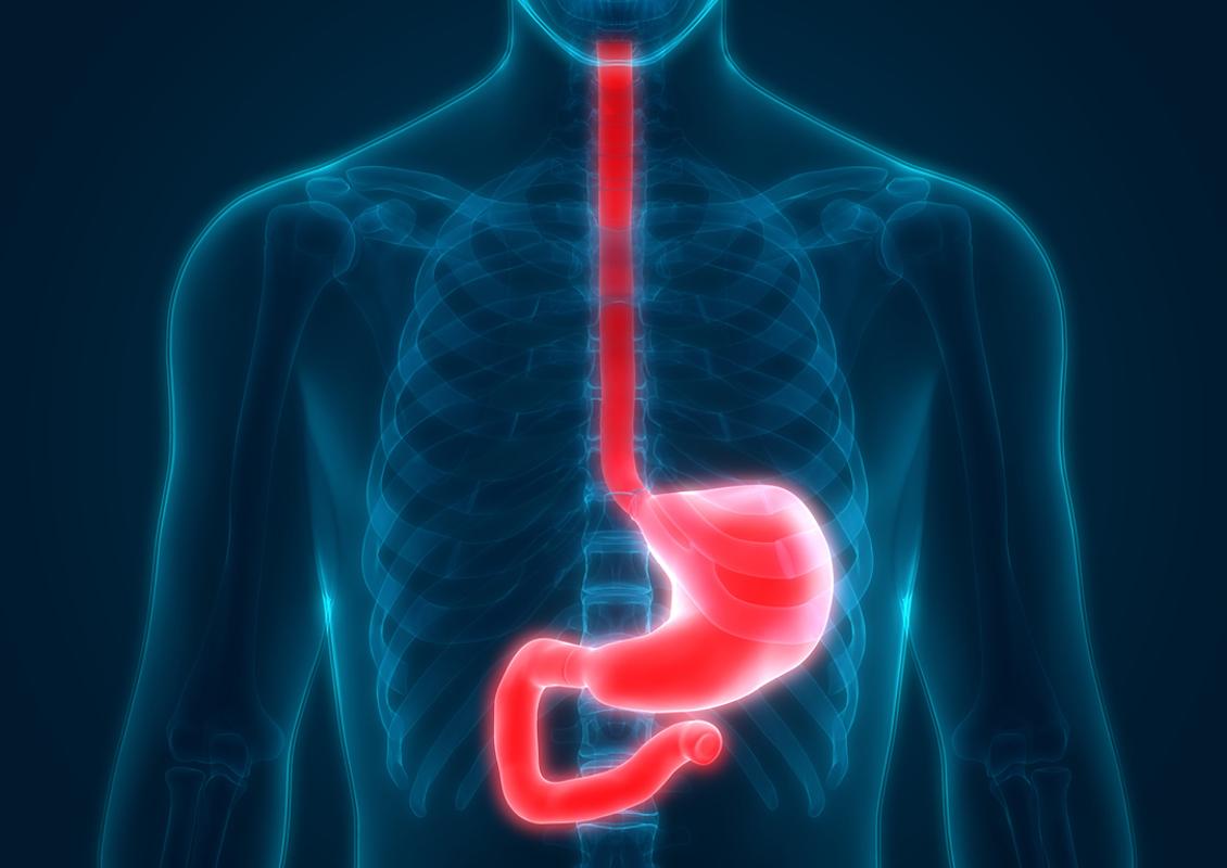 Reflux gastro-œsophagien rebelle : penser à l’œsophagite à éosinophile