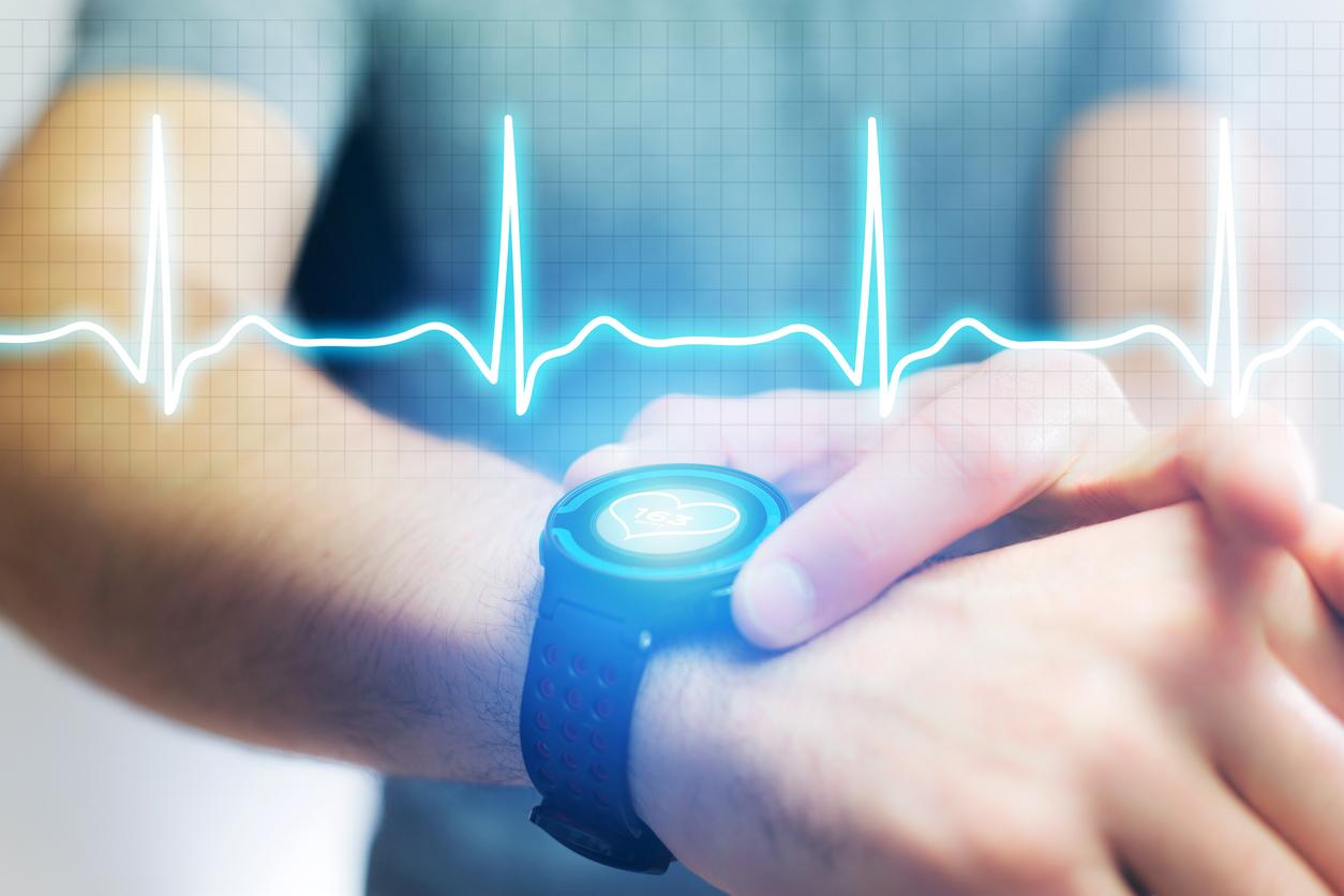 FA découverte sur une montre connectée : anticoaguler, surveiller ou rassurer ?