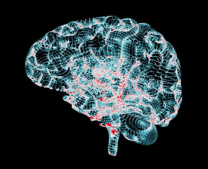 Alzheimer : un nouveau cadre de recherche pour une définition biologique de la maladie
