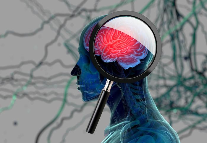 Anticholinergique : prescrits contre la dépression et le Parkinson, ils accentuent les risques de démence 