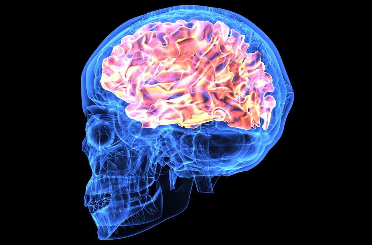 Alzheimer : les ultrasons focalisés amélioreraient l’efficacité des anticorps anti-amyloïde 