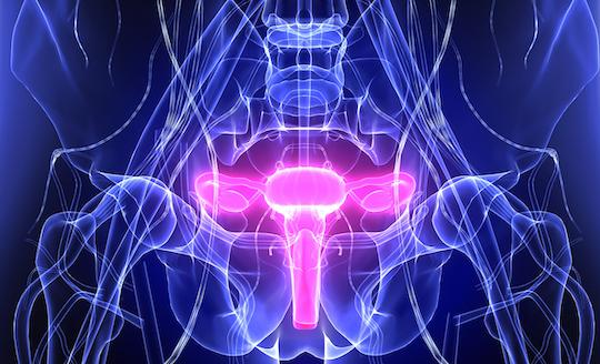 Cancers de l’ovaire platine-résistants : intérêt d’un inhibiteur d’ATR 