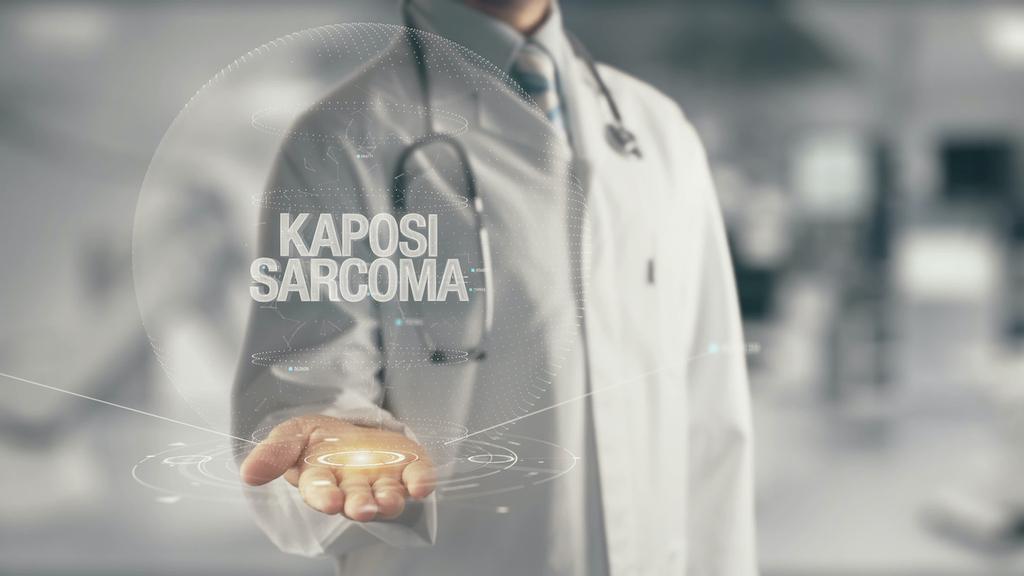 Sarcome de Kaposi : premiers résultats prometteurs de l'immunothérapie