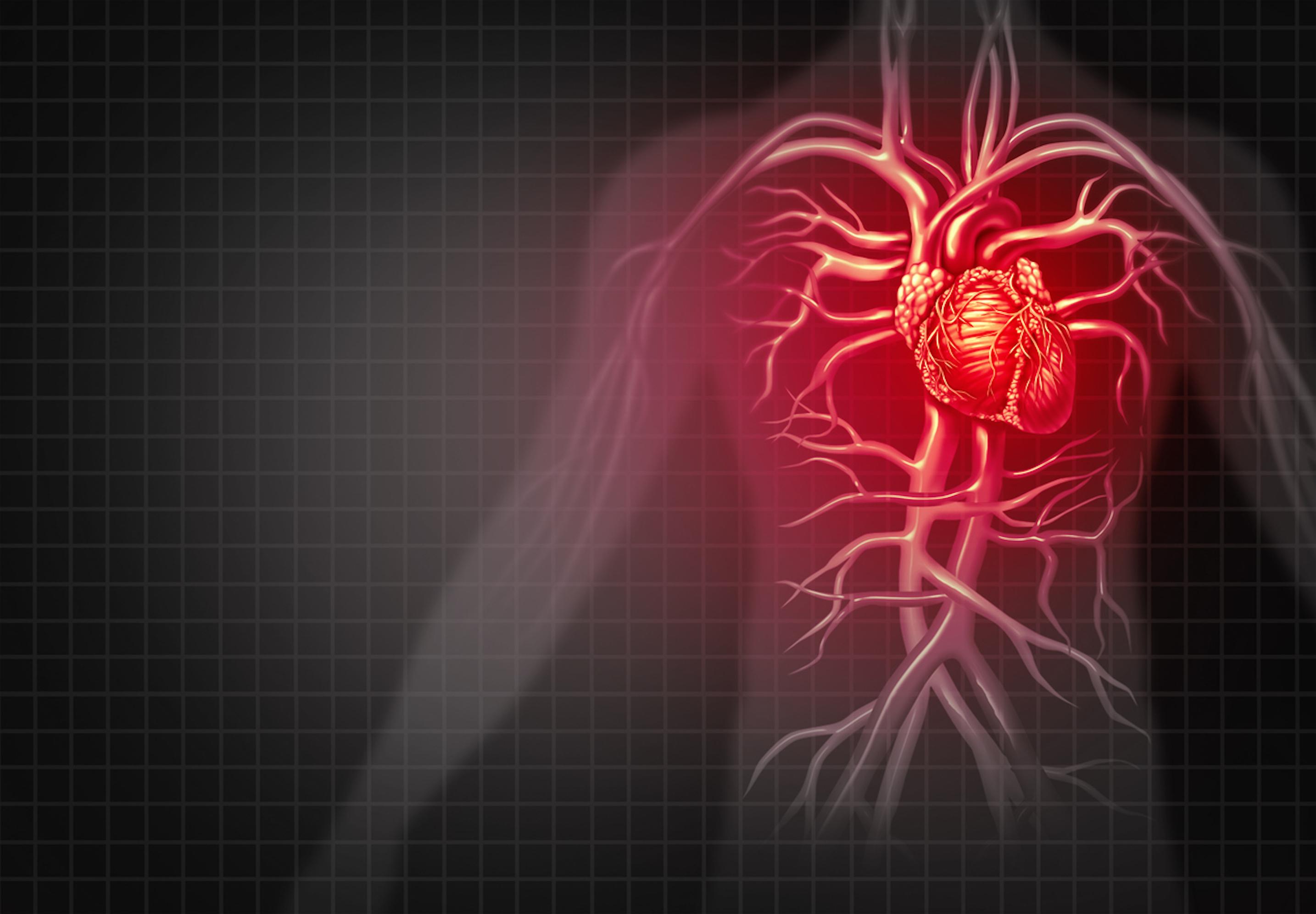 Risque cardiovasculaire : les MICI multiplient par 9 le risque de crise cardiaque