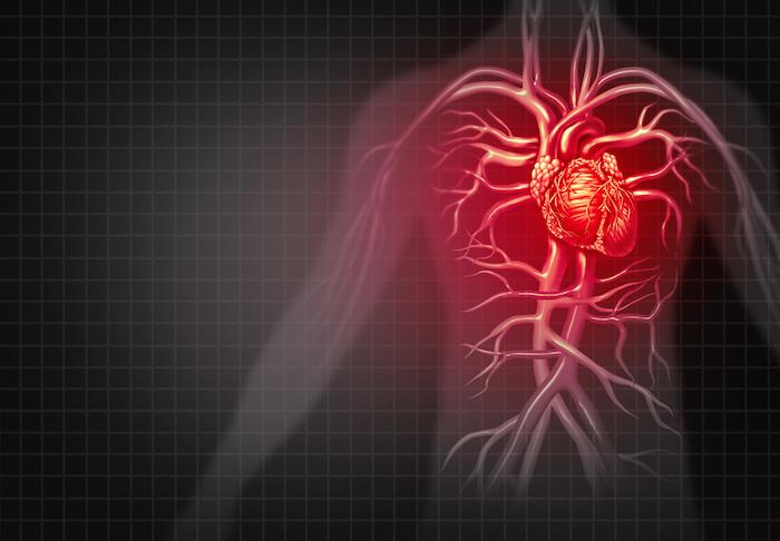 Insuffisance cardiaque : l'IC n'est pas associée à un risque accru de cancer 