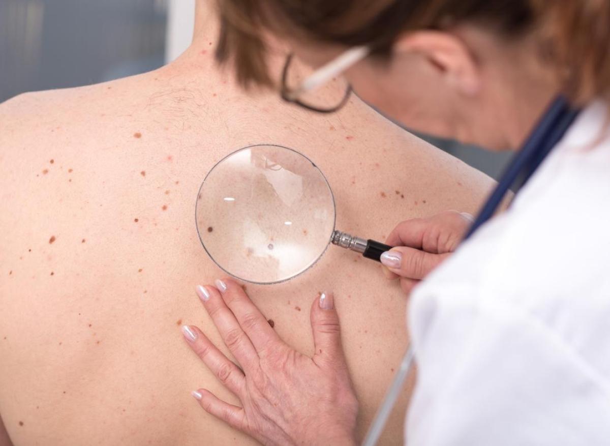 Les dermatologues trop peu nombreux : la moitié des français renonce à consulter 