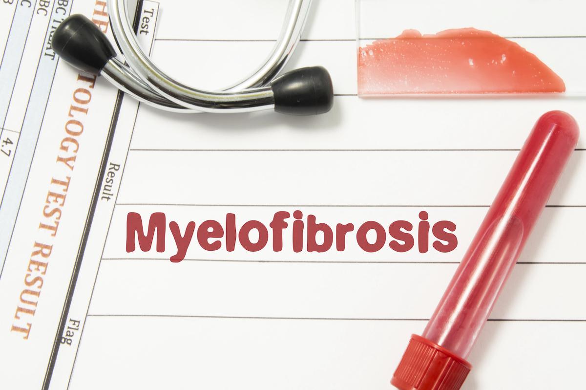 Myélofibrose secondaire : risque thrombotique augmenté