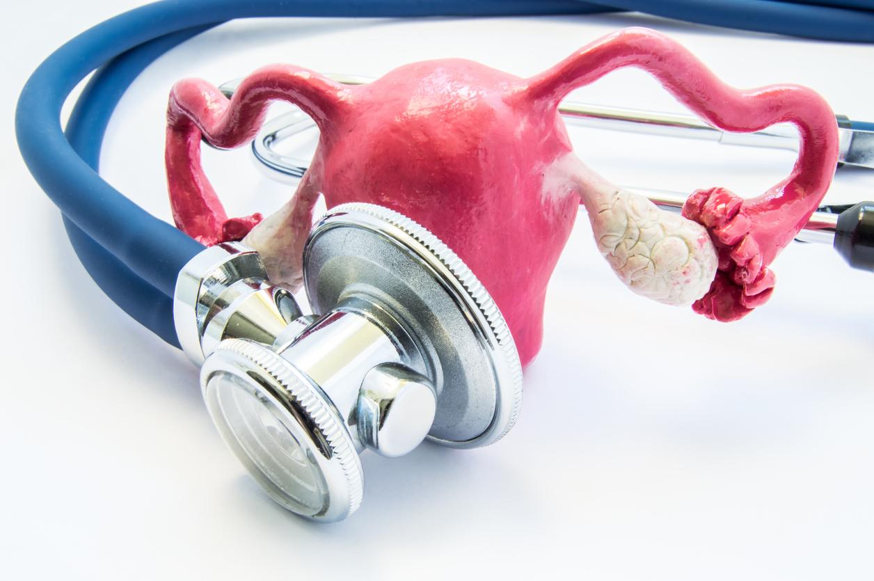 Ménorragies : l'ablation de l'endomètre associée à la pose d'un DIU réduit le recours à l'hystérectomie 