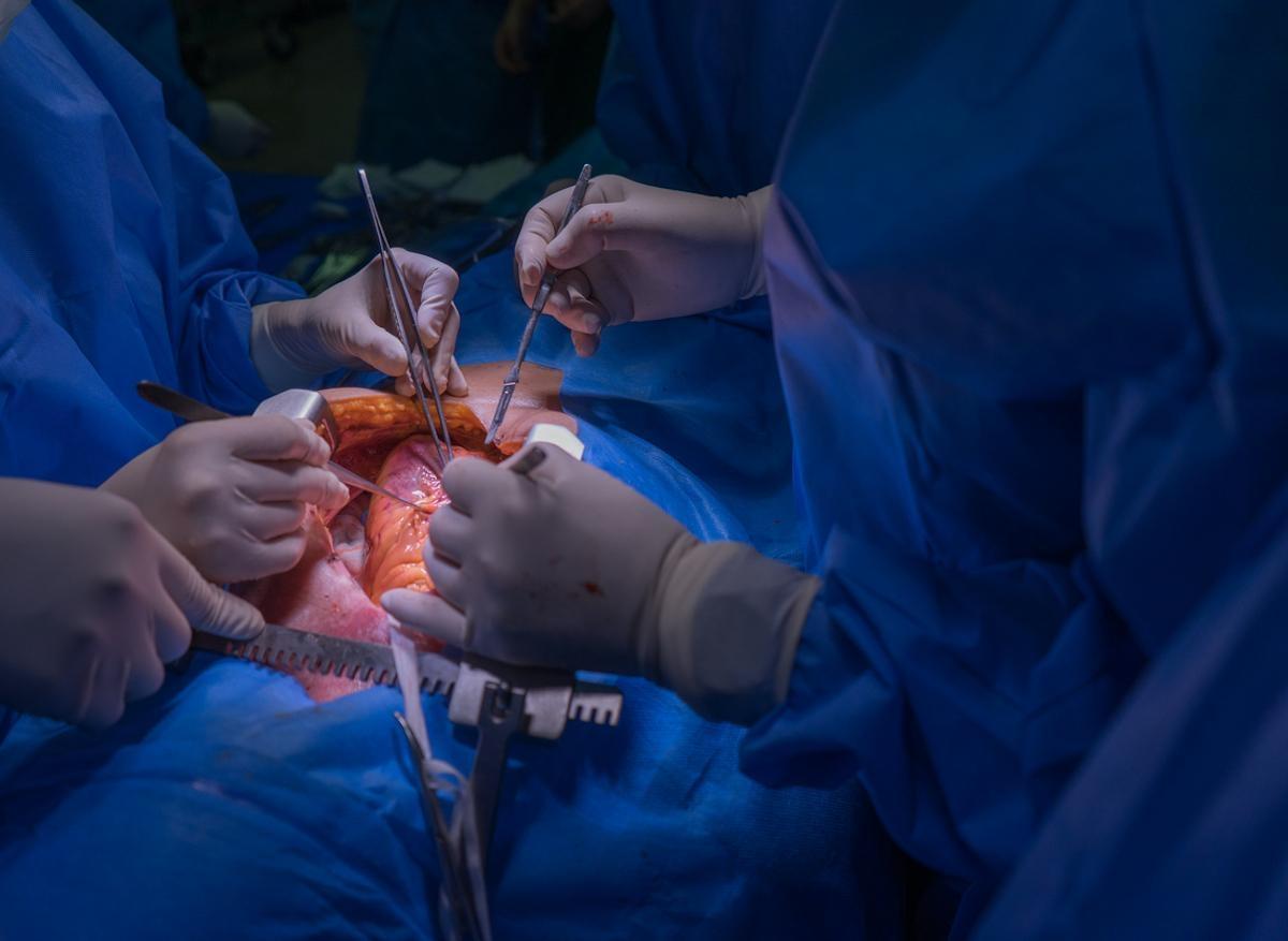 Covid-19 :  moins de chirurgies cardiaques depuis la pandémie 