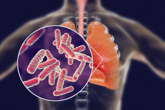 Journée mondiale : la pneumonie causée par une bactérie est la plus dangereuse pour le cœur 