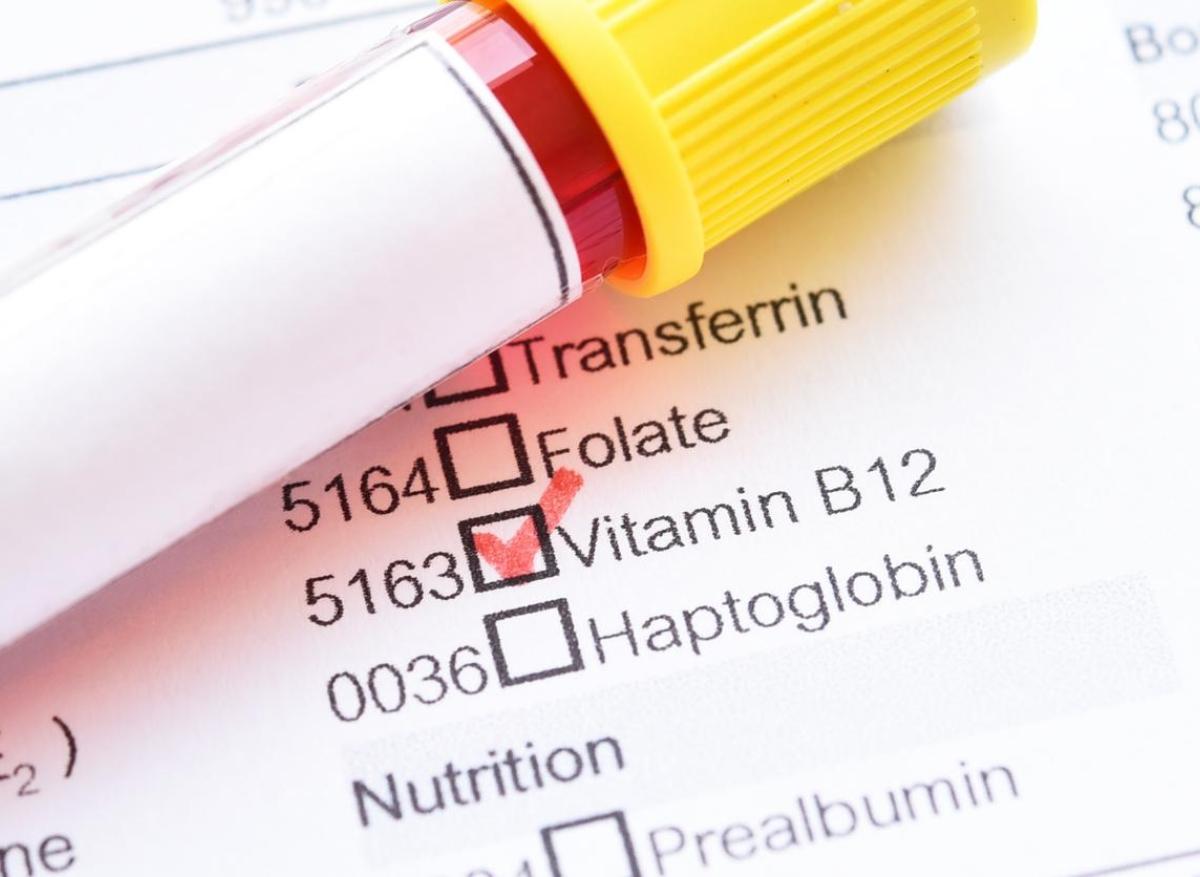 Parkinson : la vitamine B12 réduirait le risque de développer la maladie