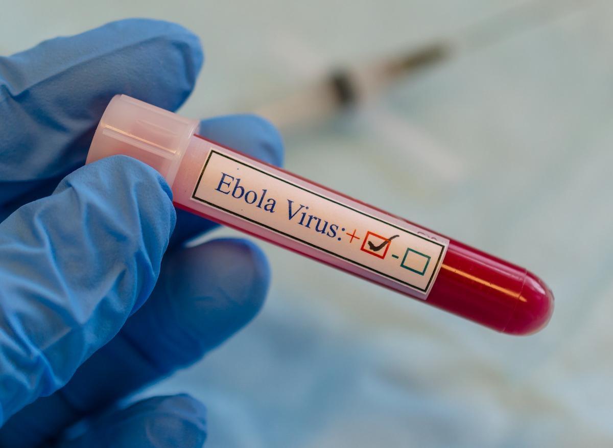Ebola : le virus quiescent 5 ans dans le corps d’un patient avant de réapparaître
