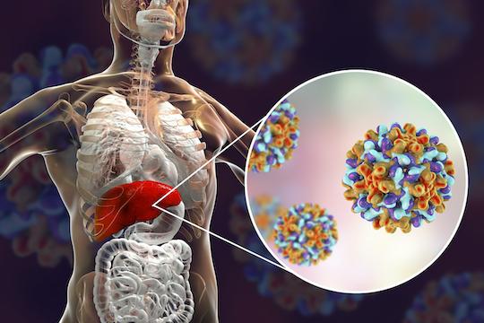 COVID-19 : les signes digestifs seraient associés à une évolution plus sévère 