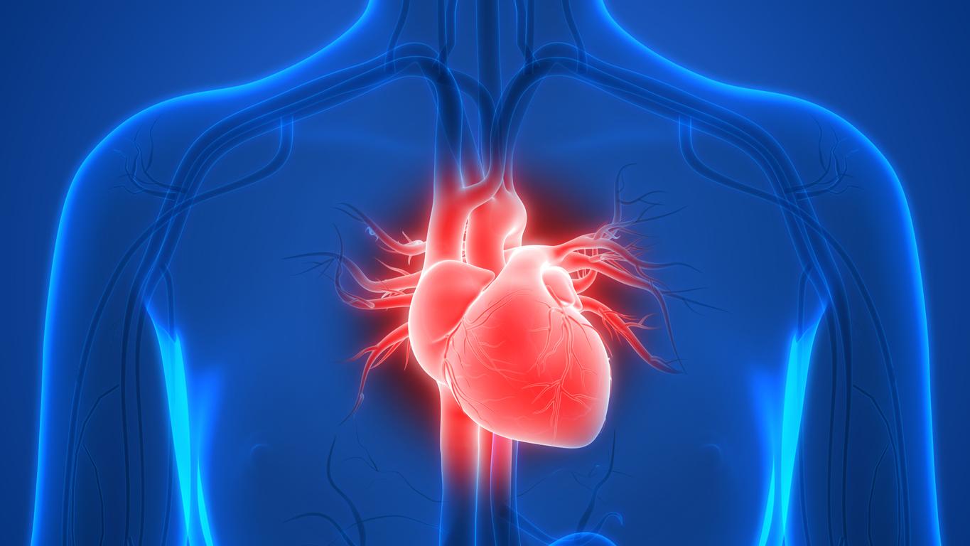 Insuffisance cardiaque : le fer intraveineux réduit les hospitalisations et les décès