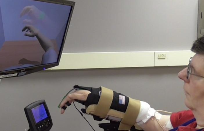 Tétraplégie : un Américain retrouve l’usage de son bras avec une neuroprothèse