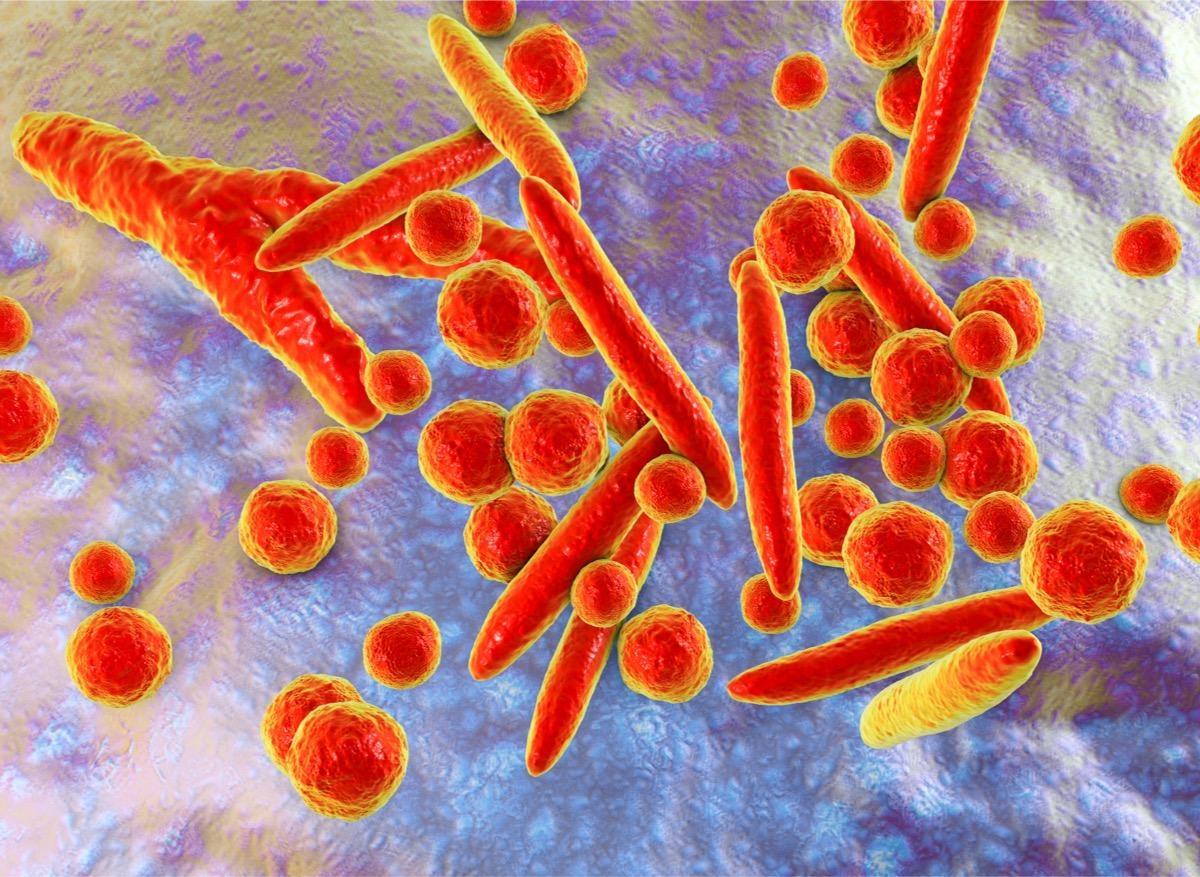 IST : Mycoplasma genitalium de plus en plus résistante aux antibiotiques