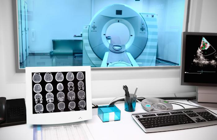 Alzheimer : une super IRM pour explorer la matière grise