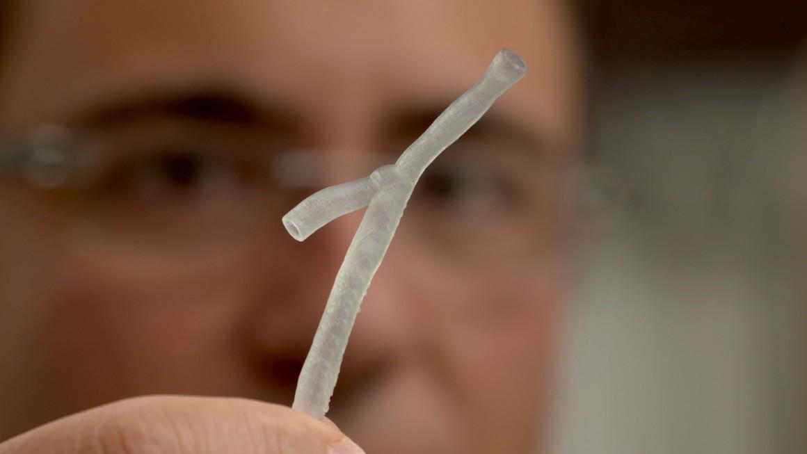 Coronaropathies : des stents sur-mesure grâce à l'impression 3D