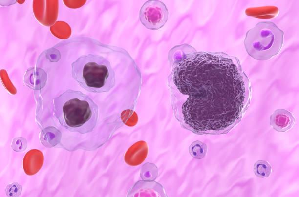 Dupilumab : un risque accru de lymphome qui nécessite une surveillance rapprochée