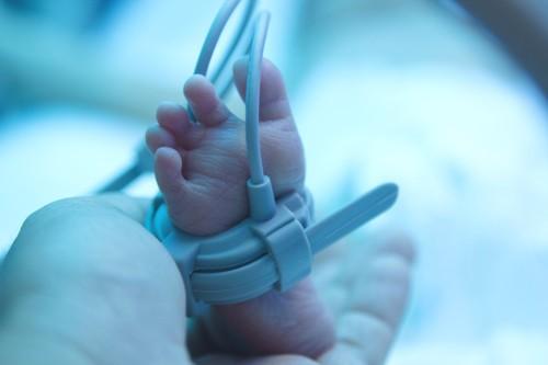 Prématurité : le petit poids de naissance associé à un risque de troubles psychologiques
