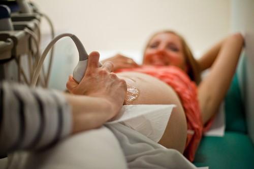 Infertilité : 3 femmes sur 4 traitées par PMA ont un enfant