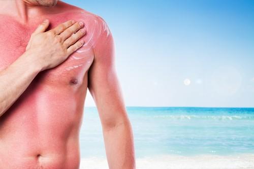 Crèmes solaires : pas toujours efficaces contre les UVA