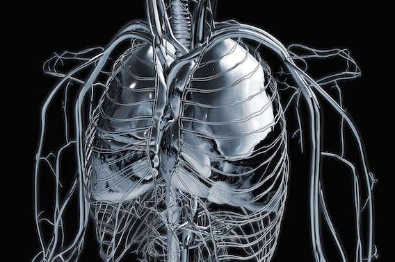 La radiothérapie stéréotaxique fait aussi bien que la chirurgie pour le traitement des métastases pulmonaires