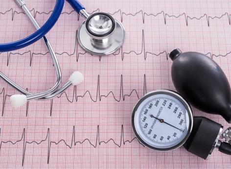 Fibrillation atriale : le diagnostic précoce à partir d'une prise de sang