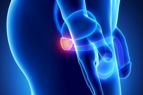 Cancer de la prostate : l’IRM multiparamétrique éviterait une biopsie sur 4