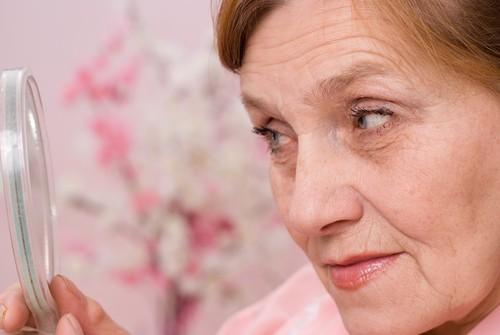 Alzheimer : la rosacée associée à une augmentation du risque
