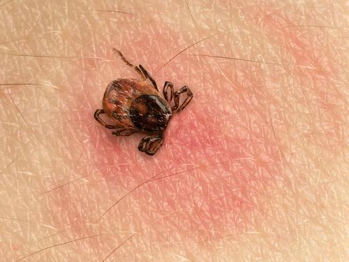 « Lyme chronique » : l’Académie de Médecine monte au créneau