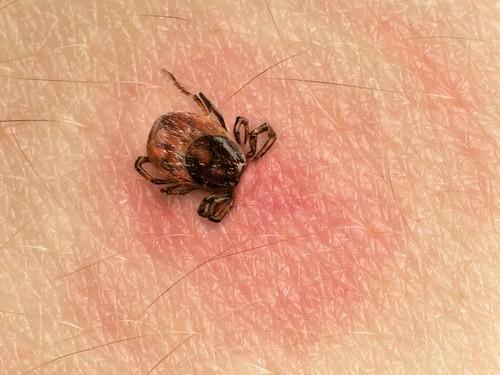 Maladie de Lyme : la controverse rebondit à l'Académie de médecine