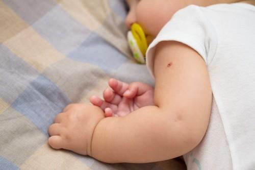 BCG : la vaccination du nourrisson est recommandée au cours du 2ème mois
