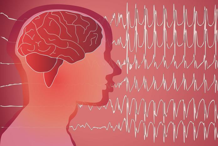 Epilepsie résistantes : un dérivé du cannabis permet de réduire les crises