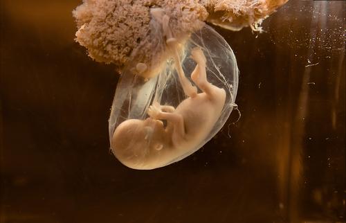 Grossesse : l'ibuprofène au 1er trimestre affecte la fertilité des petites filles