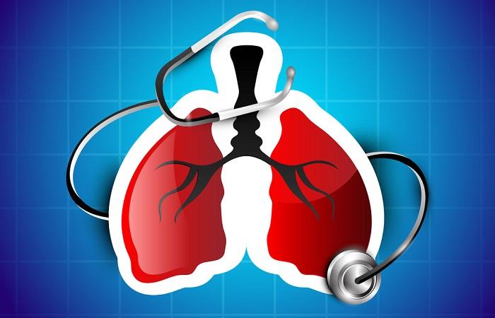 Asthme sévère : la thermoplastie confirme son intérêt dans une étude en vraie vie