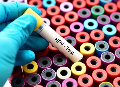 Dépistage du cancer du col de l'utérus : le test HPV recommandé après 30 ans 