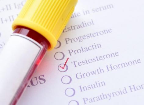 Cancer de la prostate : après prostatectomie, la testostérone n'est plus taboue