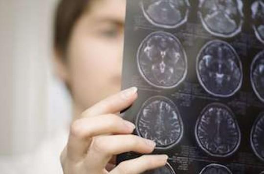 Schizophrénie : des anomalies dans le cerveau spécifiques des formes cliniques